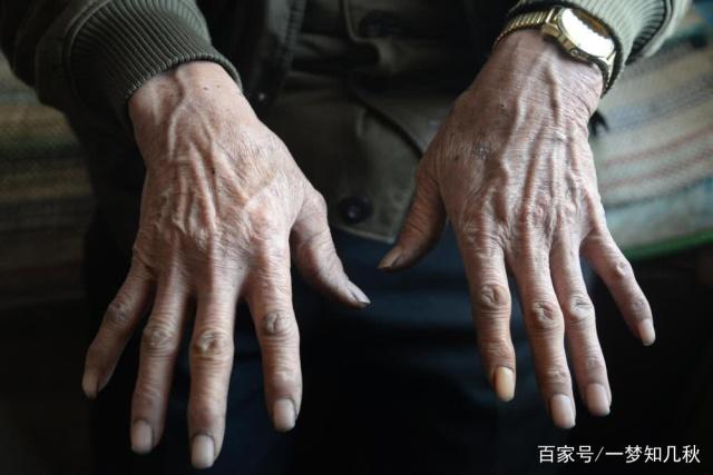 574e9258d109b3ded25a9f4a8279d085810a4c71.jpeg@f_auto 七旬老人单身至今一辈子为弟弟而活,不敢去侄儿家过年:怕讨人嫌